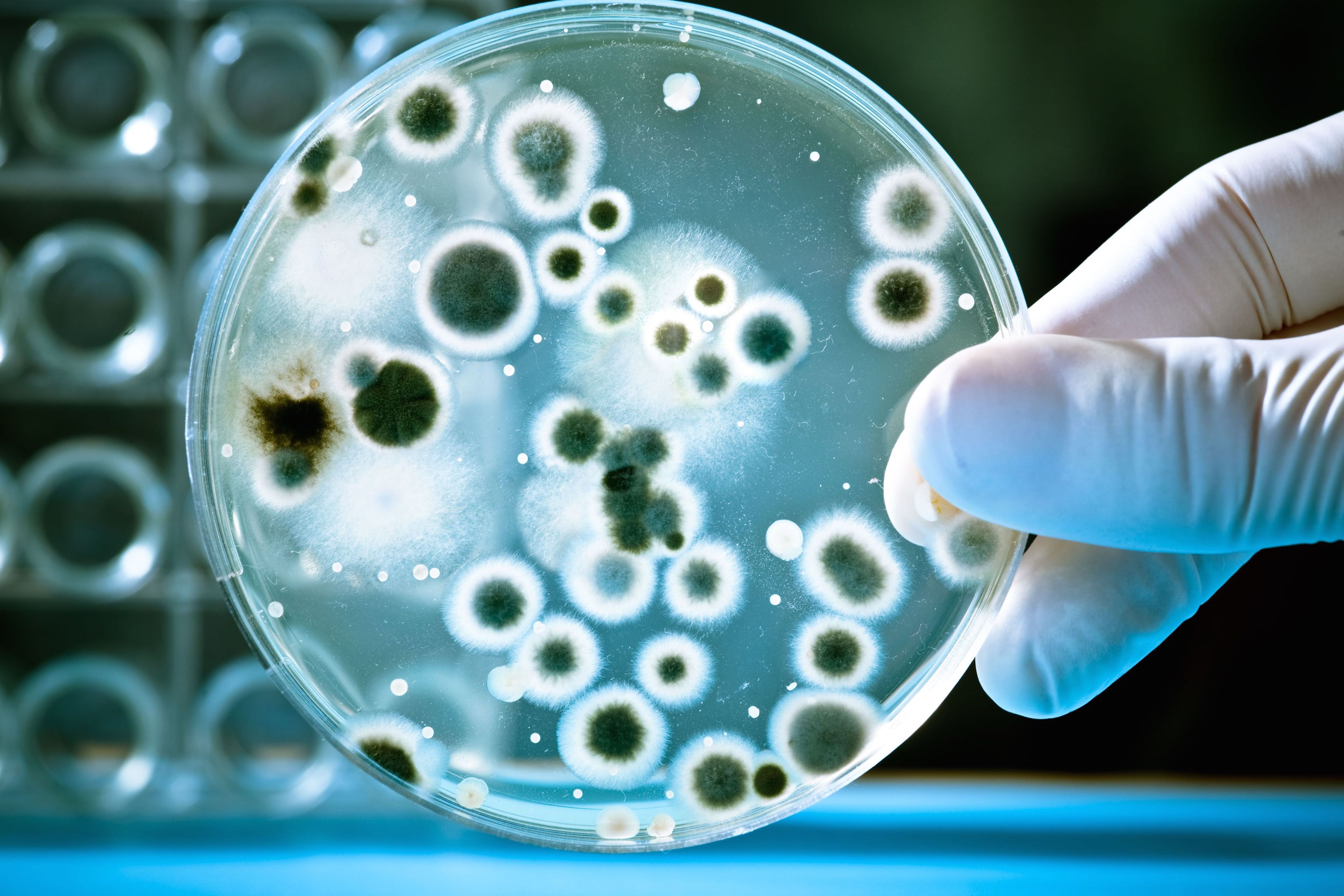 Durante Estos Días Se Desarrolla El Congreso De Microbiología Más